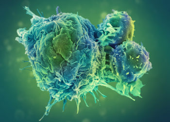 ADVOCACY MSD: Sustaining progress in cancer care in the COVID-19 era